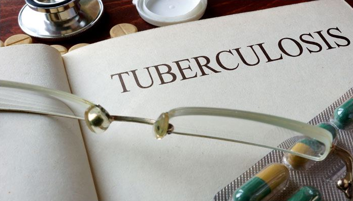 Assam the first state to launch bedaquiline drug for TB