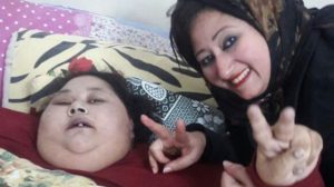 World's heaviest woman Egyptian Eman Ahmed loses 50kg in 12 days