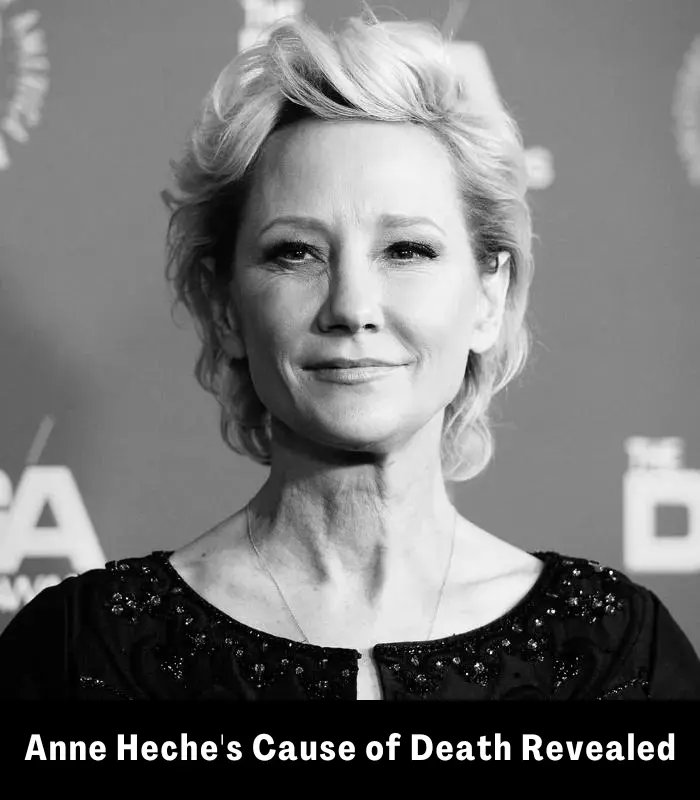 Anne Heche cause of death revealed